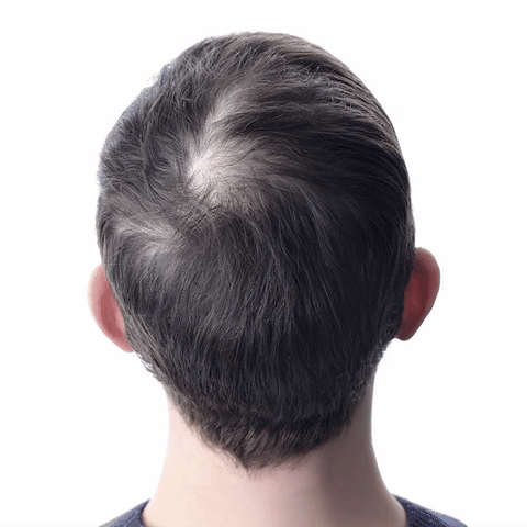 Șampon Orylo™ RootBoost pentru regenerarea părului