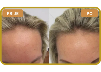 Orylo™ RootBoost Šampon za obnovu kose v2 (Women)