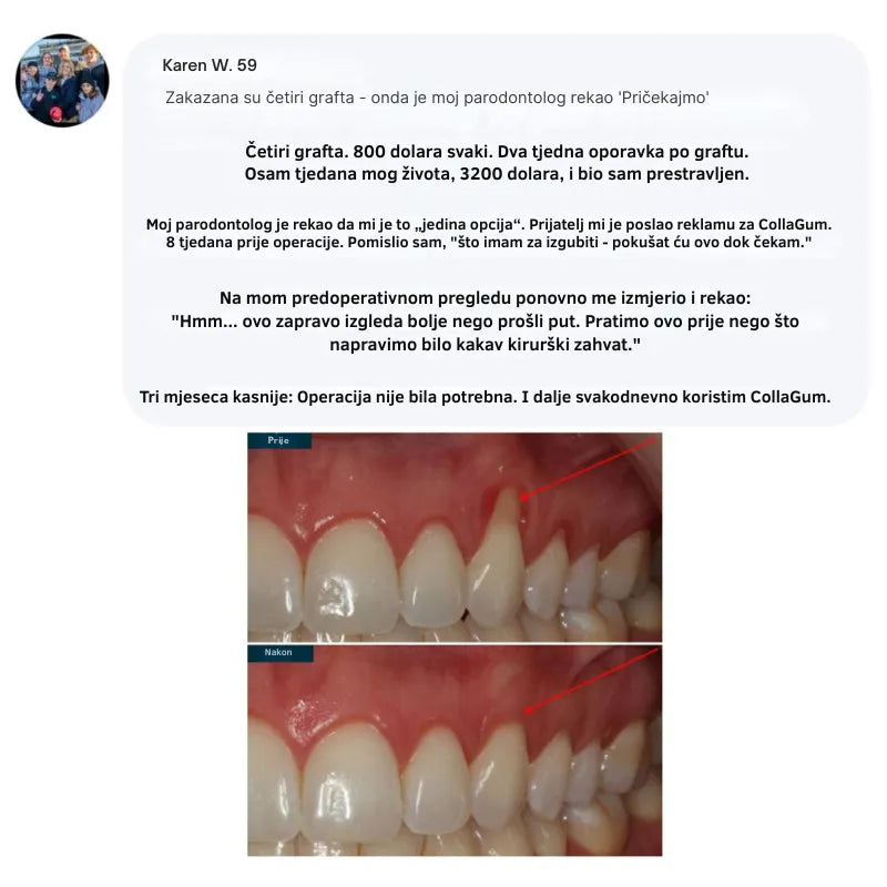 Collagen Powder for Gums