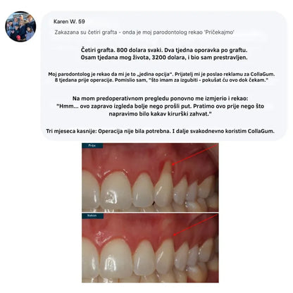 Collagen Powder for Gums