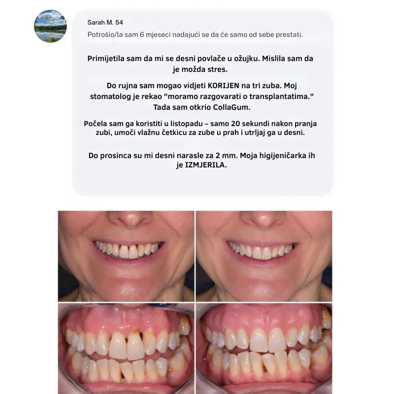 Collagen Powder for Gums