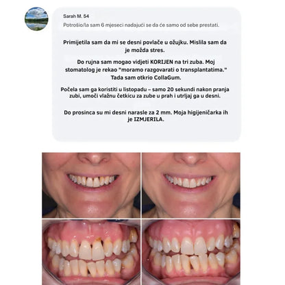 Collagen Powder for Gums