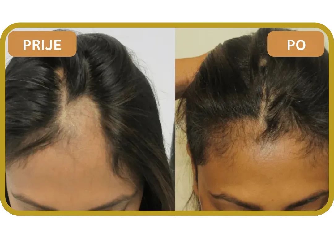 Orylo™ RootBoost Šampon za obnovu kose v2 (Women)