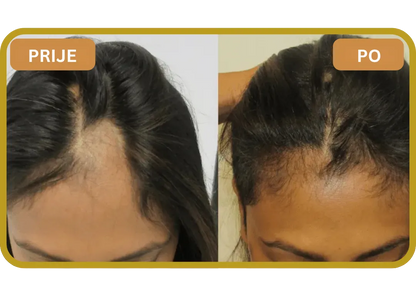 Orylo™ RootBoost Šampon za obnovu kose v2 (Women)