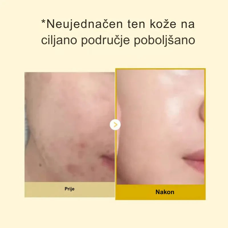Maska s kojičnom kiselinom i kurkumom