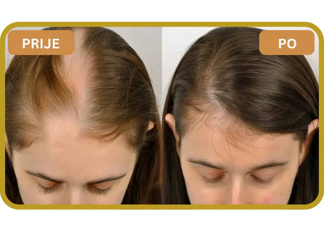 Orylo™ RootBoost Šampon za obnovu kose v2 (Women)