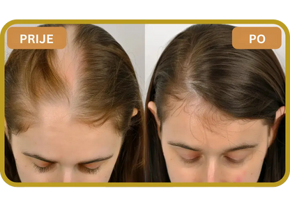 Orylo™ RootBoost Šampon za obnovu kose v2 (Women)