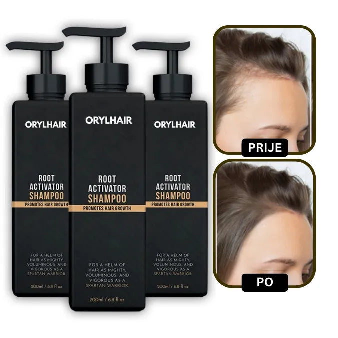 Orylo™ RootBoost Šampon za obnovu kose v2 (Women)