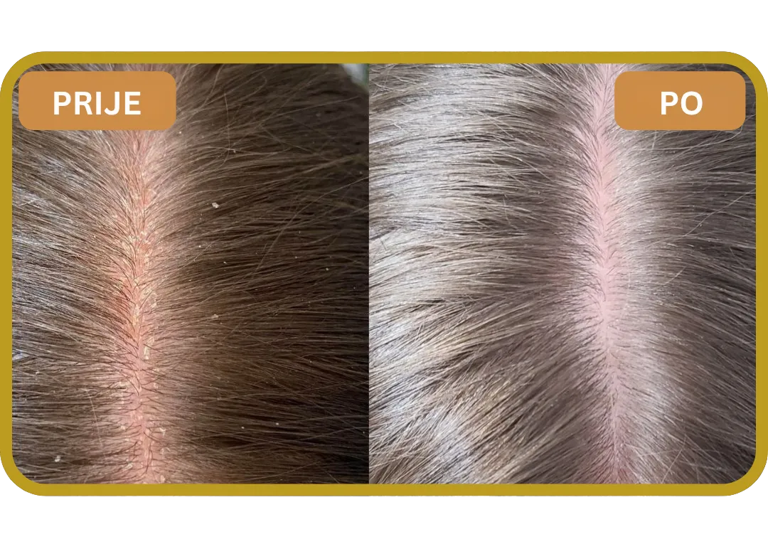 Orylo™ RootBoost Šampon za obnovu kose v2 (Women)