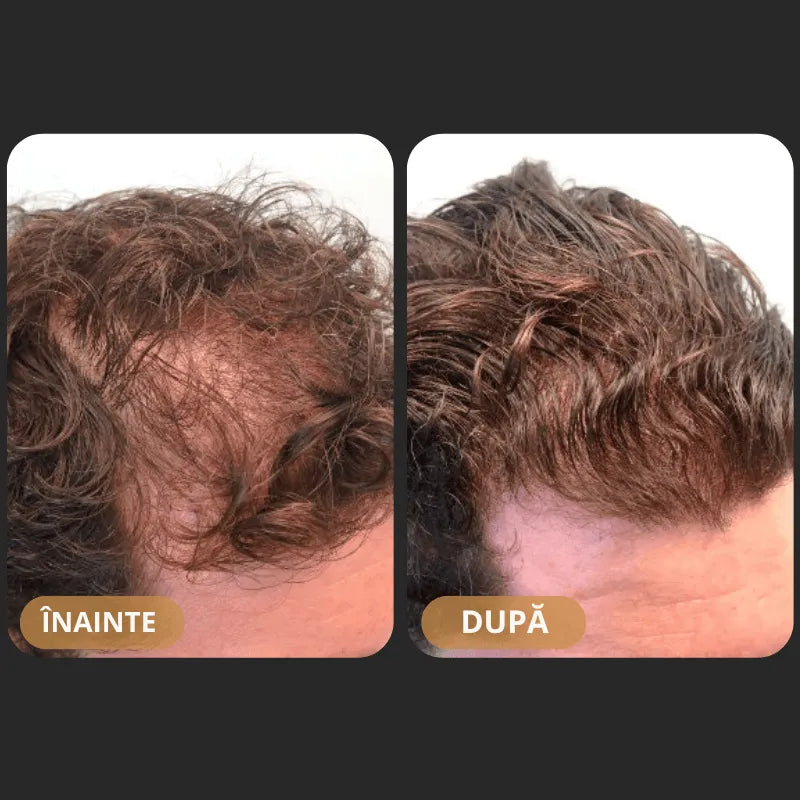 Șampon Orylo™ RootBoost pentru regenerarea părului