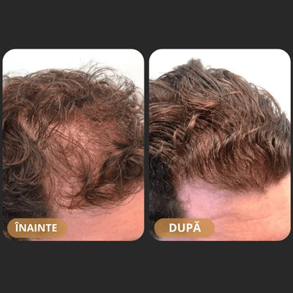 Șampon Orylo™ RootBoost pentru regenerarea părului