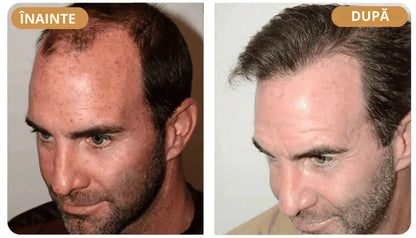 Șampon Orylo™ RootBoost pentru regenerarea părului