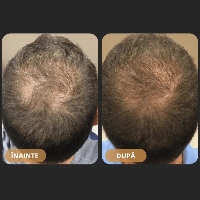 Șampon Orylo™ RootBoost pentru regenerarea părului