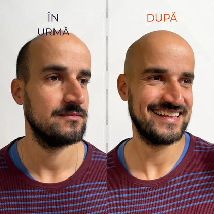 ORYLO | OryloEdge™ SET DE RAS