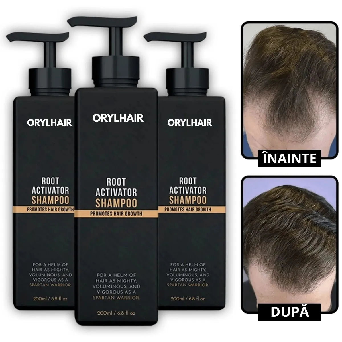 Șampon Orylo™ RootBoost pentru regenerarea părului