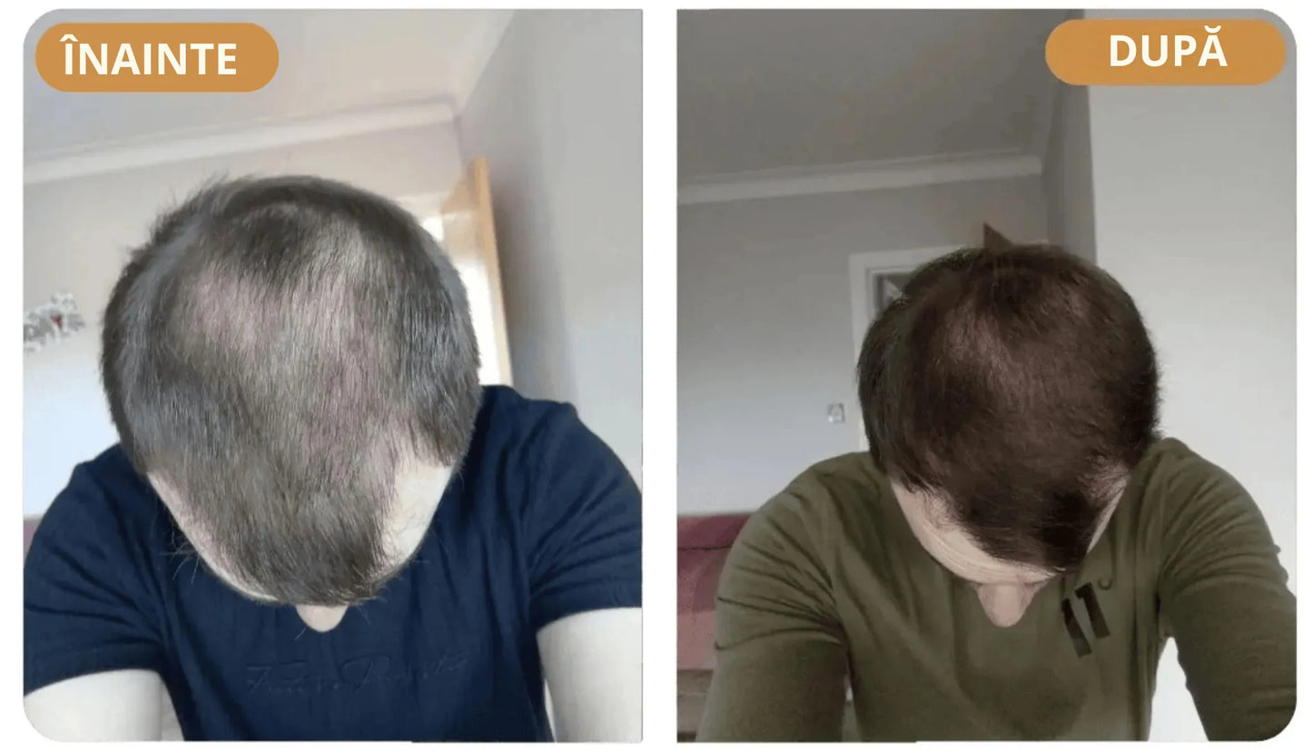 Șampon Orylo™ RootBoost pentru regenerarea părului