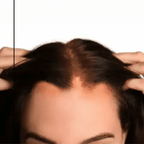 Orylo™ RootBoost Šampon za obnovu kose v2 (Women)